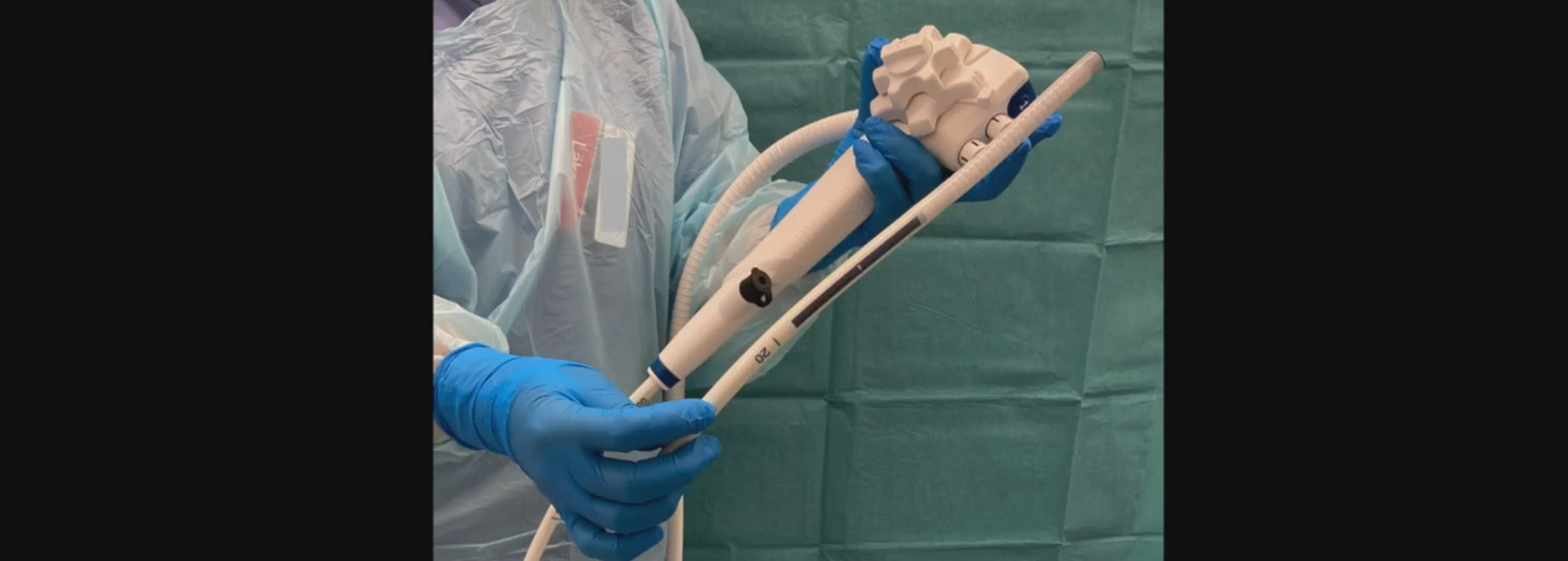 Study Finds Single-Use Gastroscopes Effective in Advanced Procedures